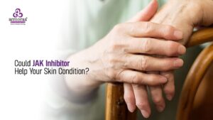 Could JAK Inhibitors Help Your Skin Condition?