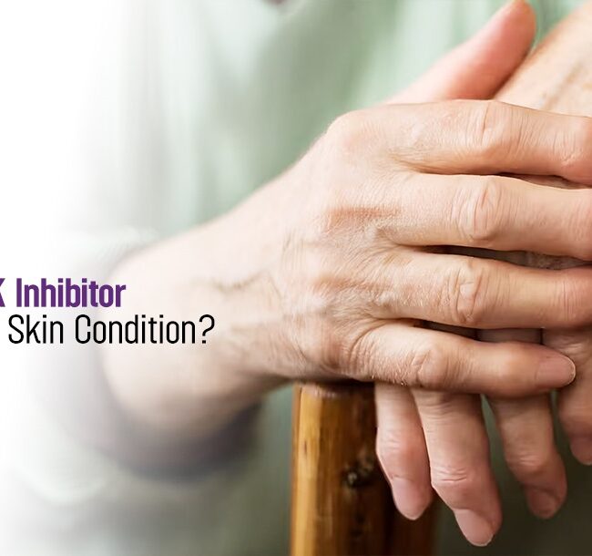 Could JAK Inhibitors Help Your Skin Condition?