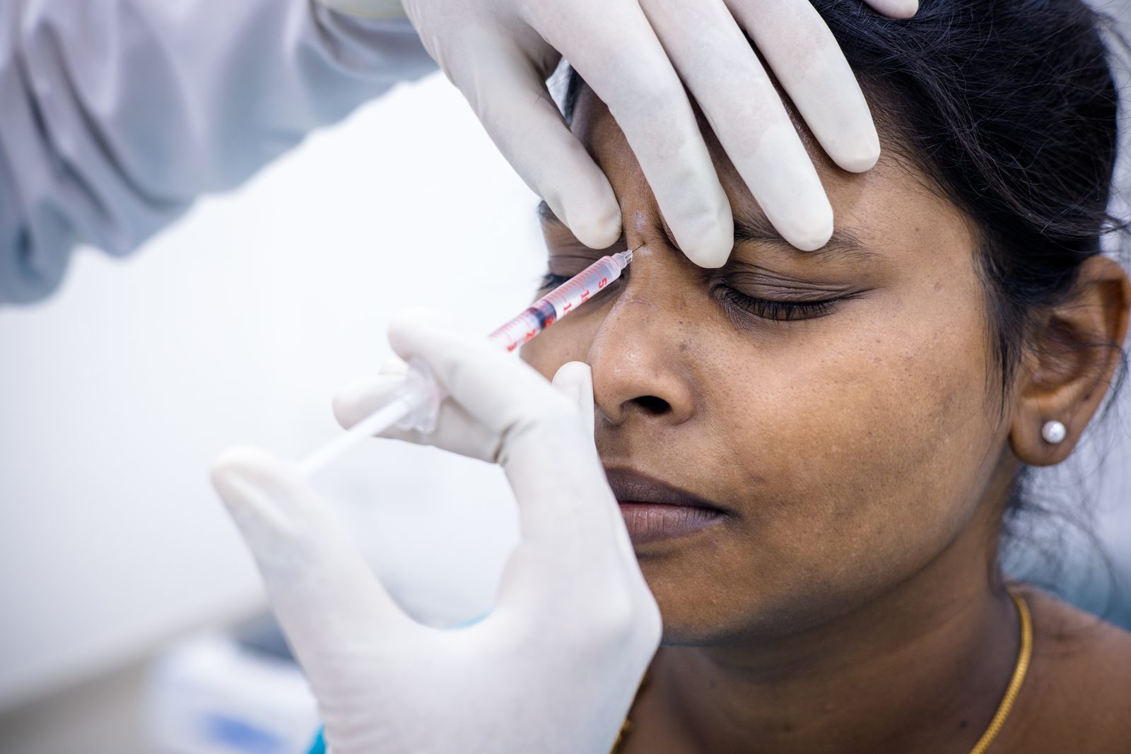 Botox injectable treatment setup at Armoraa skin clinic, Chennai