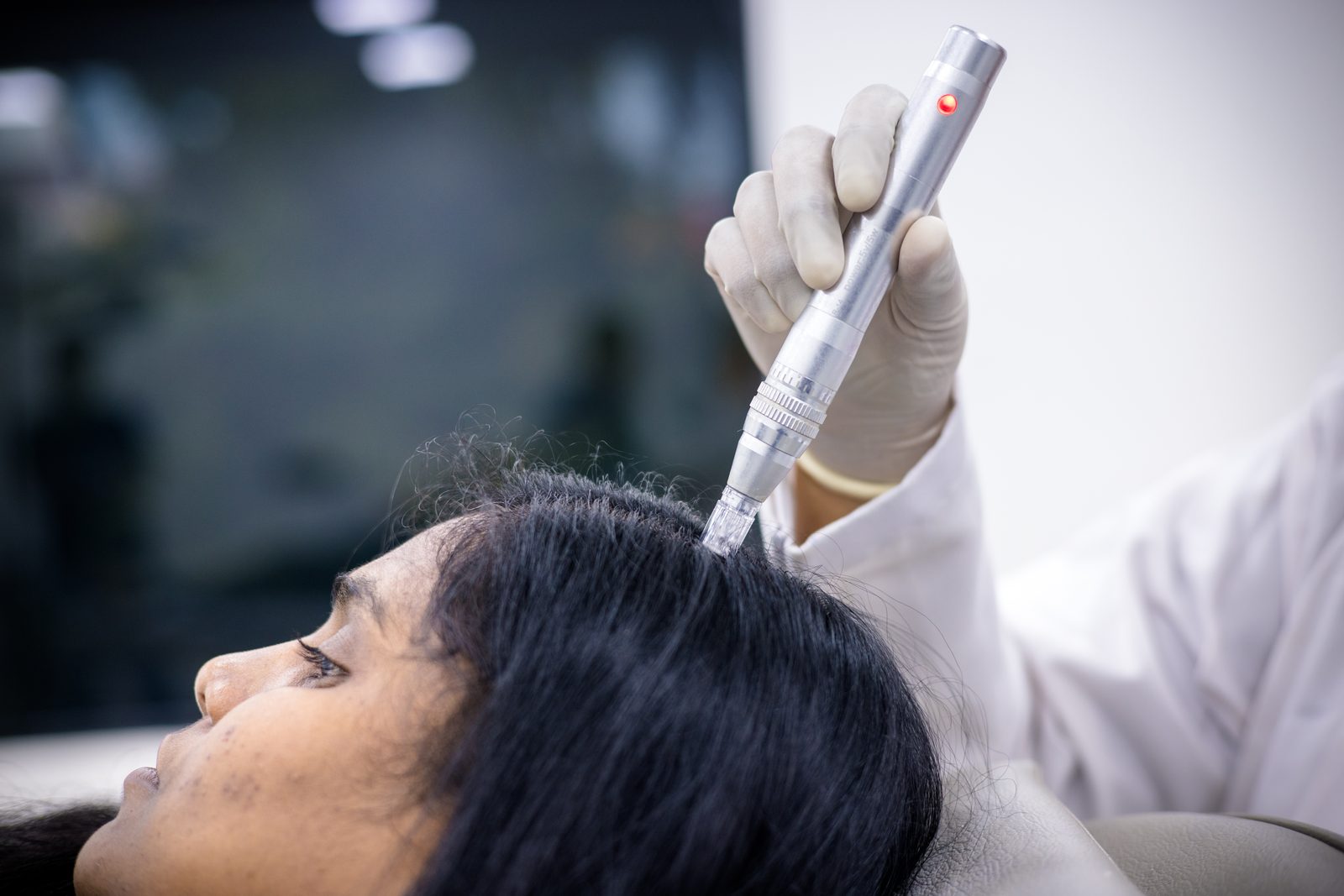 Scalp treatment technique at Armoraa skin clinic, Chennai