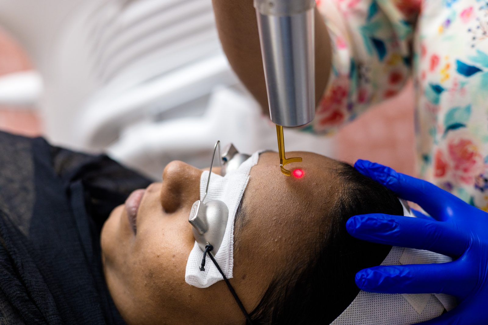 Pigment laser treatment setup at Armoraa skin clinic, Chennai