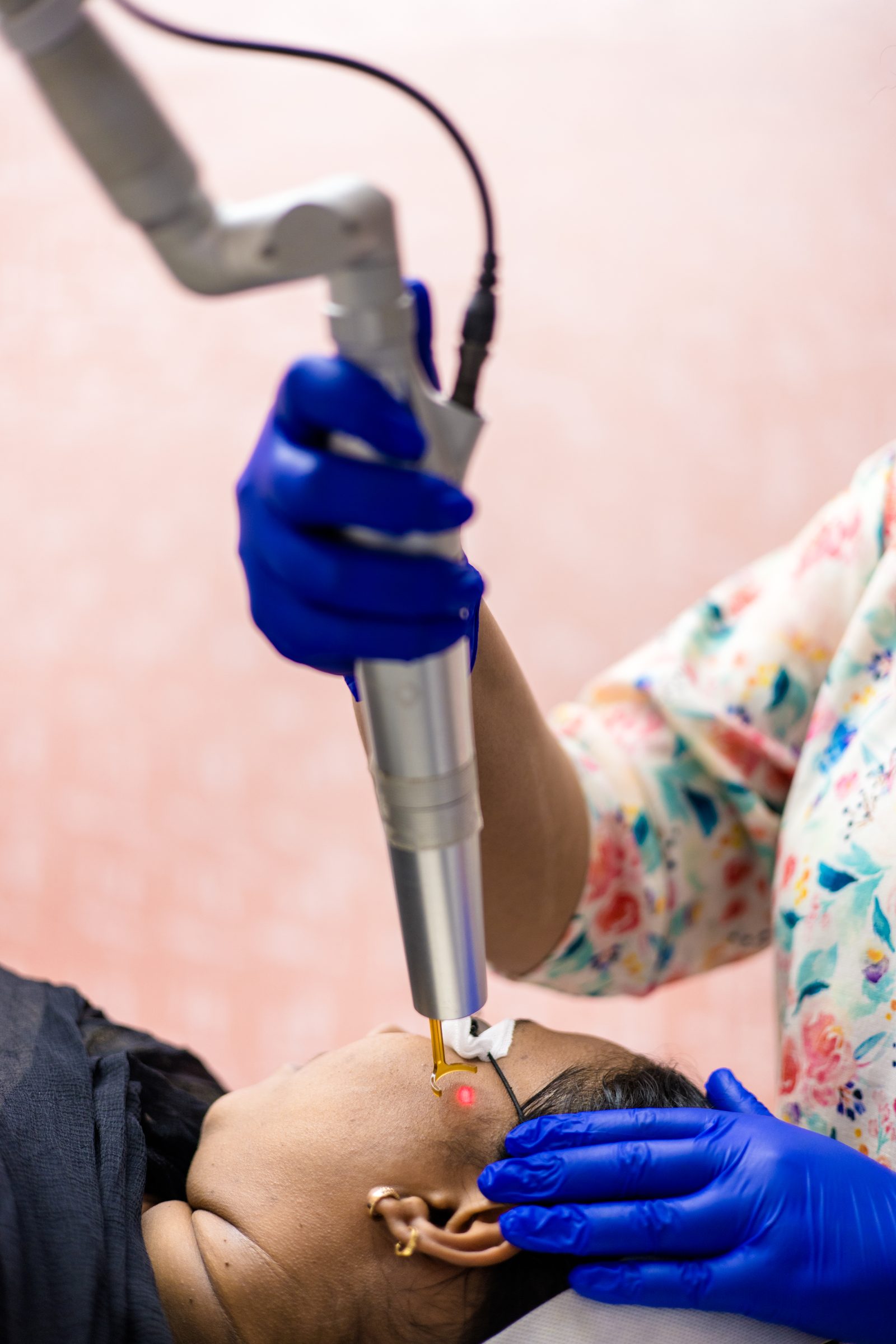 Pigment-targeted laser device at Armoraa skin clinic, Chennai
