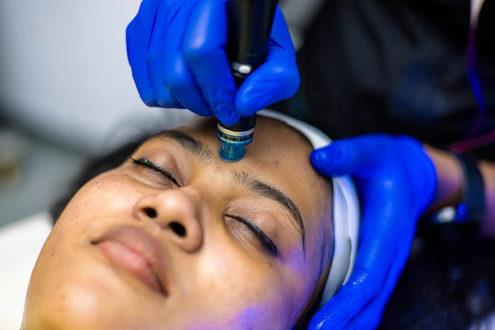 Skin rejuvenation treatment procedure at Armoraa skin clinic, Chennai