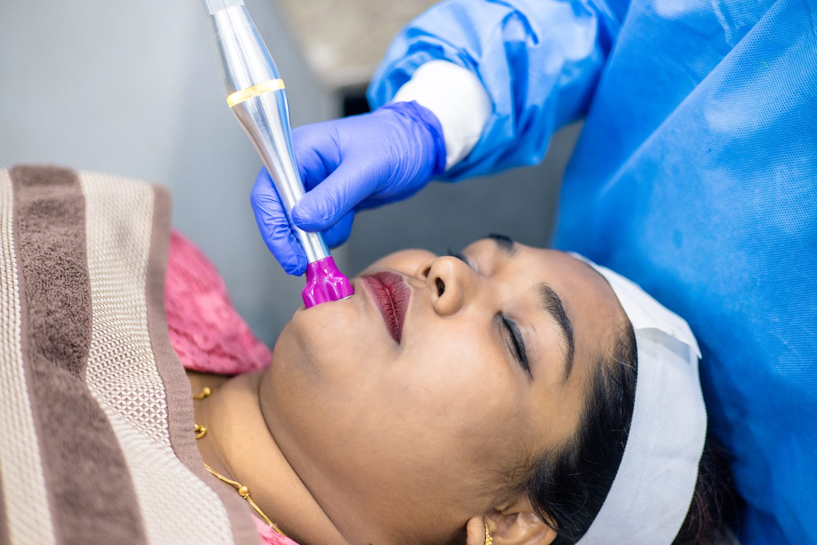 Skin tightening treatment procedure at Armoraa skin clinic, Chennai