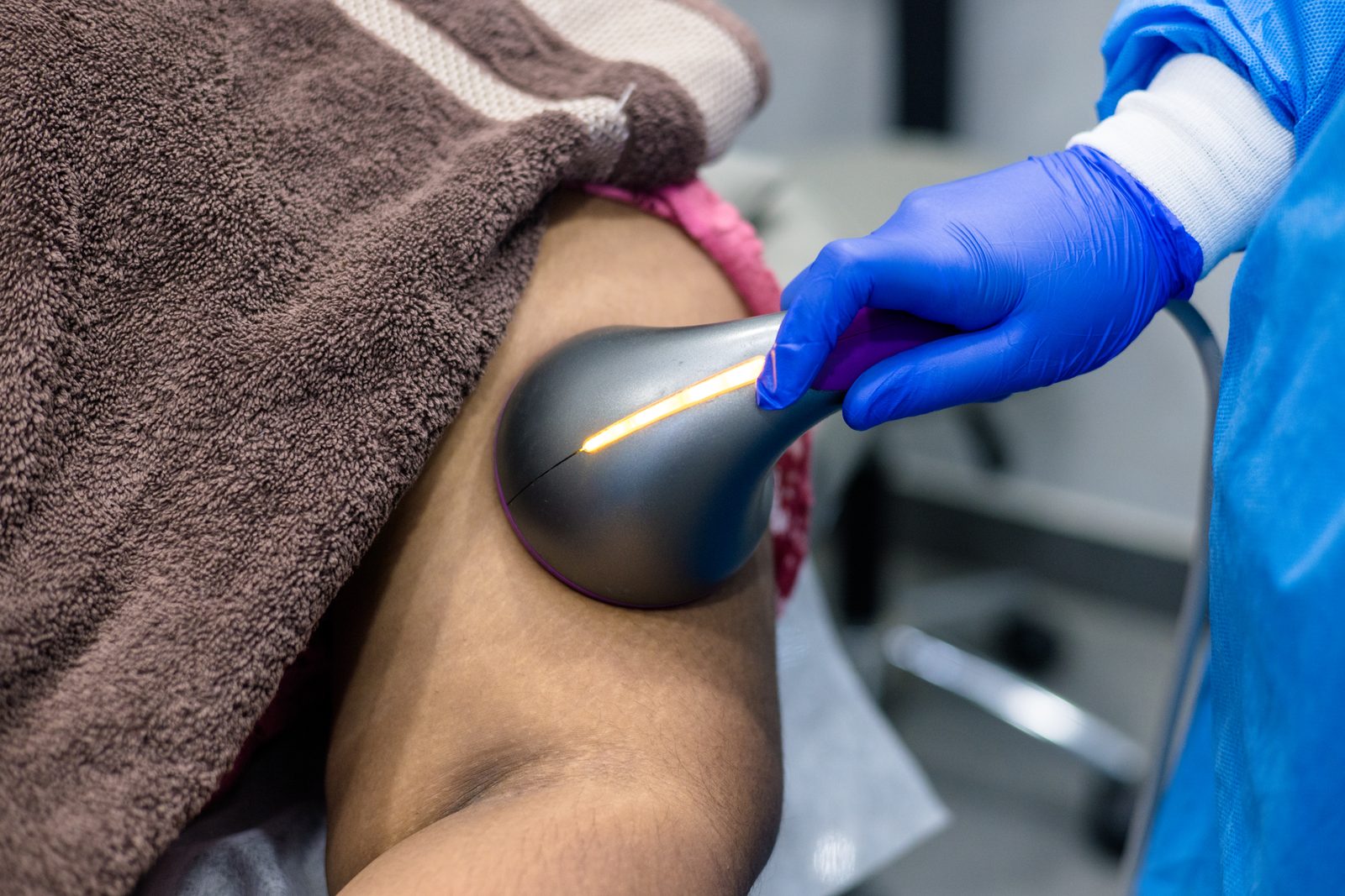 Skin tightening treatment session at Armoraa skin clinic, Chennai